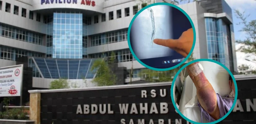 Kawat di Jantung Pasien RSUD AWS Samarinda Ternyata 21 Cm, Keluarga Minta Pihak Rumah Sakit Jujur